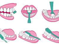 牙齿变长牙缝变宽...注意！你的牙龈正在萎缩！
