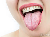 揪出来了：舌癌背后有2个“元凶”，很多人不知不觉都在做