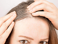 女性白头发日渐增加，别以为老了，可能是体内缺乏这3种营养元素